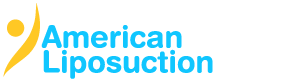 AmericanLiposuction.com